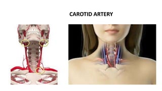 CAROTID ARTERY
 