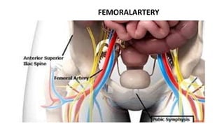 FEMORALARTERY
 
