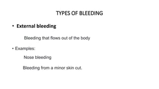 TYPES OF BLEEDING
• External bleeding
Bleeding that flows out of the body
• Examples:
Nose bleeding
Bleeding from a minor skin cut.
 