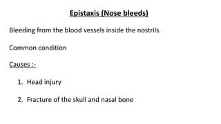 Epistaxis (Nose bleeds)
Bleeding from the blood vessels inside the nostrils.
Common condition
Causes :-
1. Head injury
2. Fracture of the skull and nasal bone
 