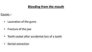 Bleeding from the mouth
Causes :-
• Laceration of the gums
• Fracture of the jaw
• Tooth socket after accidental loss of a tooth
• Dental extraction
 