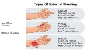 වේගවෙන් විහිදුවනවා
துடிக்கிறது
Tuṭikkiṟatu
 