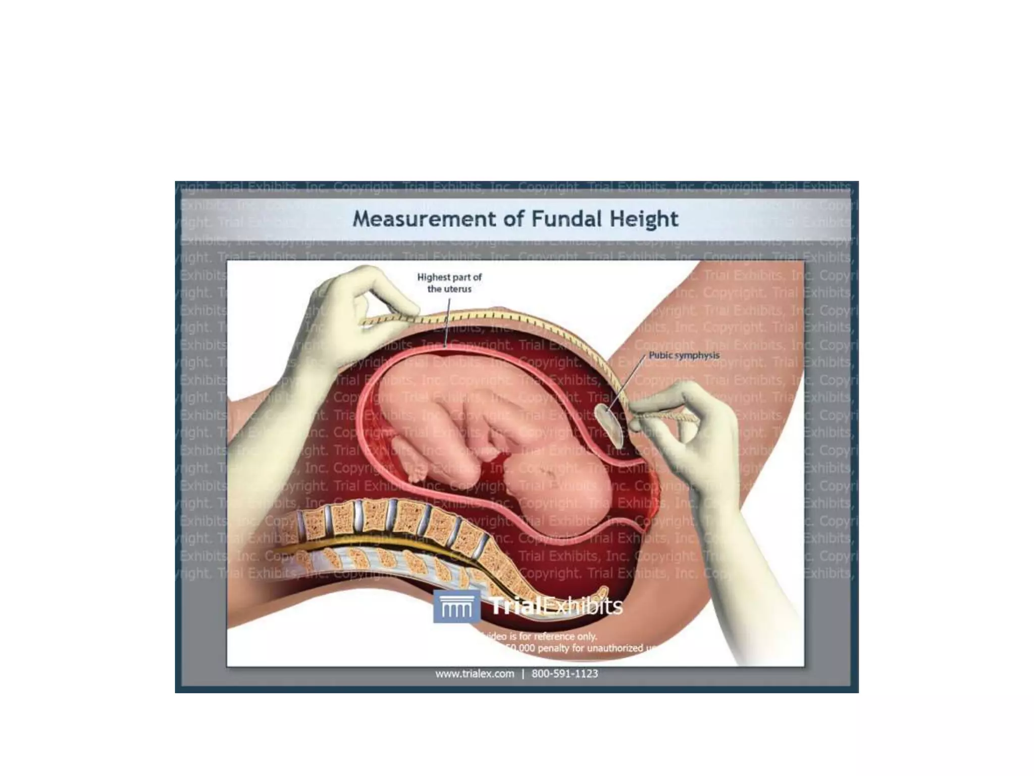 measuring of fundal height.pptx