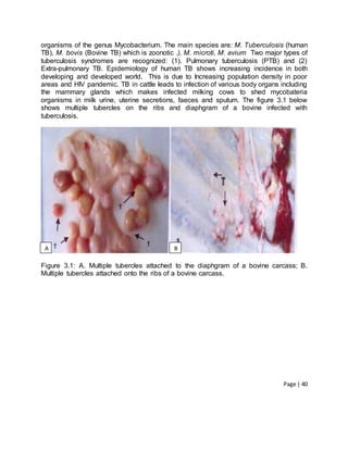 Page | 40
organisms of the genus Mycobacterium. The main species are: M. Tuberculosis (human
TB), M. bovis (Bovine TB) which is zoonotic .), M. microti, M. avium Two major types of
tuberculosis syndromes are recognized: (1). Pulmonary tuberculosis (PTB) and (2)
Extra-pulmonary TB. Epidemiology of human TB shows increasing incidence in both
developing and developed world. This is due to Increasing population density in poor
areas and HIV pandemic. TB in cattle leads to infection of various body organs including
the mammary glands which makes infected milking cows to shed mycobateria
organisms in milk urine, uterine secretions, faeces and sputum. The figure 3.1 below
shows multiple tubercles on the ribs and diaphgram of a bovine infected with
tuberculosis.
Figure 3.1: A. Multiple tubercles attached to the diaphgram of a bovine carcass; B.
Multiple tubercles attached onto the ribs of a bovine carcass.
A B
 