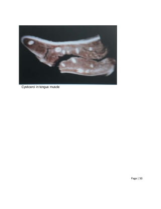 Page | 50
Cysticerci in tongue muscle
 