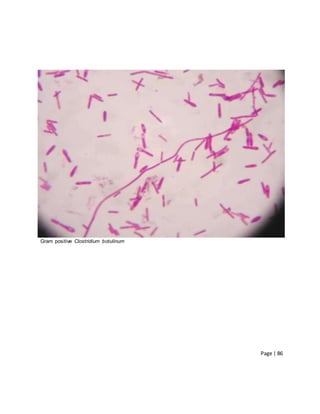 Page | 86
Gram positive Clostridium botulinum
 