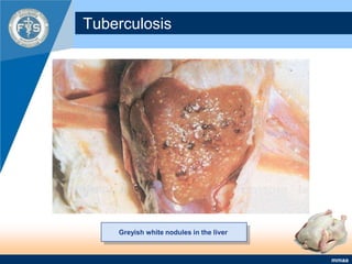 Tuberculosis Greyish white nodules in the liver 