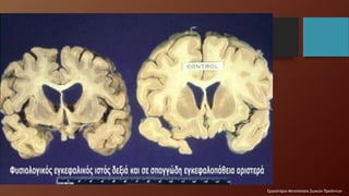 Ποιότητα κρέατος