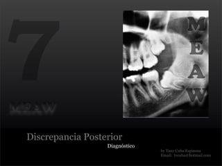 7
                                             M
                                             E
                                             A
MEAW
                                             W
 Discrepancia Posterior
                   Diagnóstico
                                 by Tany Cuba Espinoza
                                 Email: tvcuba@hotmail.com
 