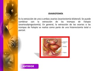 Es la extracción de uno o ambos ovarios (ovariectomía bilateral). Se puede
combinar con la extracción de las trompas de Falopio
(ovariosalpingectomía). En general, la extracción de los ovarios o las
trompas de Falopio se realiza como parte de una histerectomía total o
parcial.
OVARIOTOMÍA
 