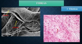  Elásticas
FIBRAS
 