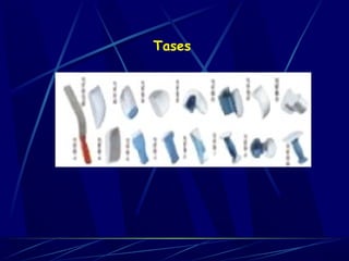 Tases 
 