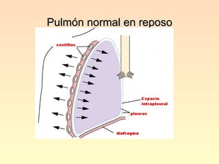 Pulmón normal en reposo 