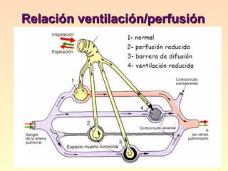 Relación ventilación/perfusión 