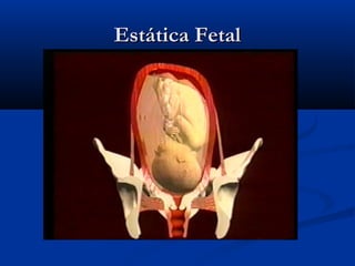 Estática Fetal
 