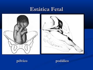 Estática Fetal




pélvico             podálico
 