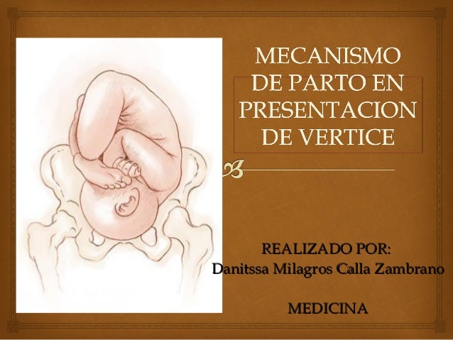 Mecanismo de parto MODALIDAD DE VERTICE, MODALIDAD CEFALICA, PARTO NO…