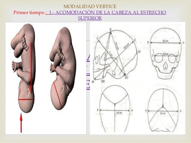 Mecanismo de parto MODALIDAD DE VERTICE, MODALIDAD CEFALICA, PARTO NO…