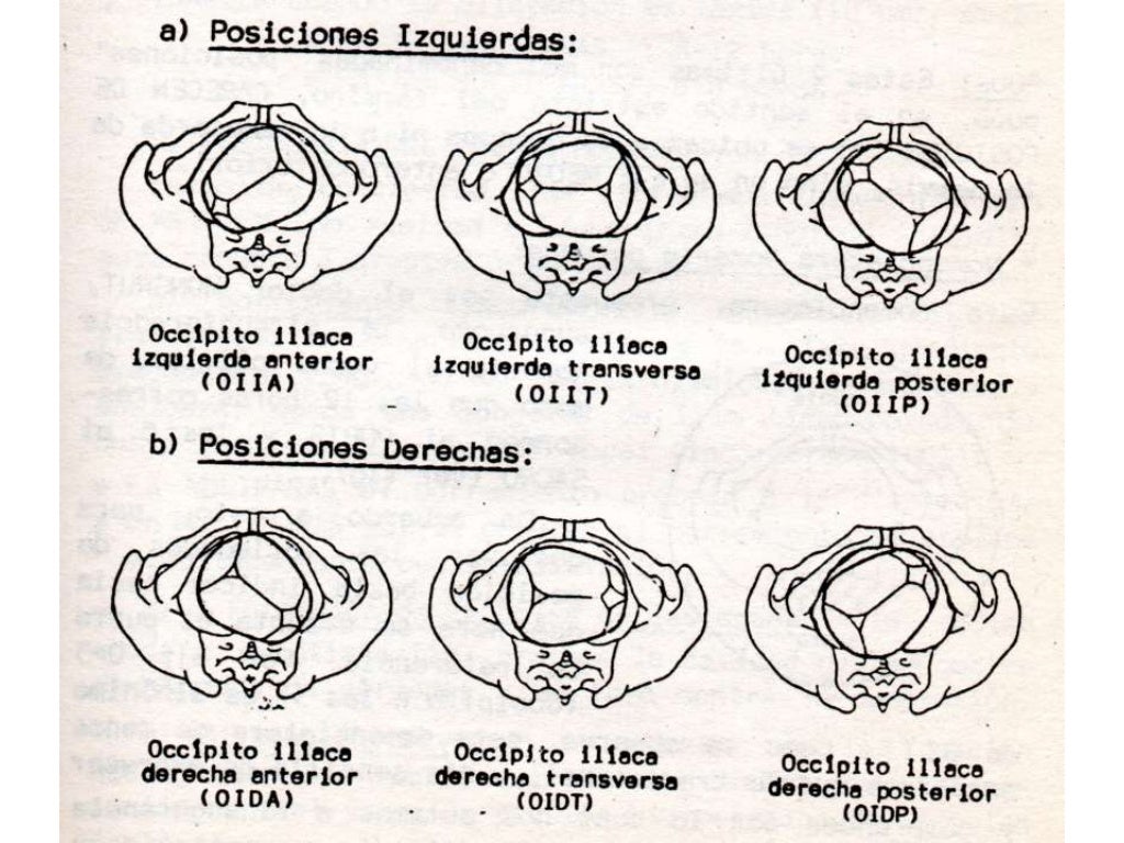 MECANISMO DE PARTO VERTICE OIIA