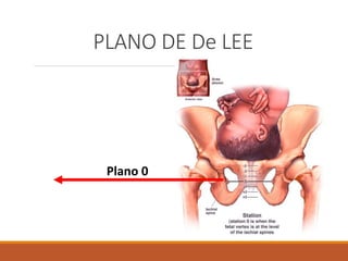 PLANO DE De LEE
Plano 0
 