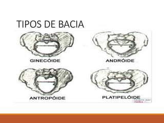 TIPOS DE BACIA
 