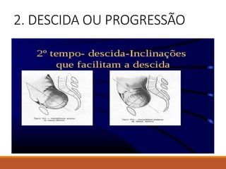 2. DESCIDA OU PROGRESSÃO
 
