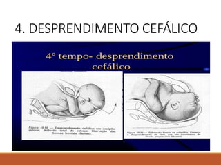 4. DESPRENDIMENTO CEFÁLICO
 