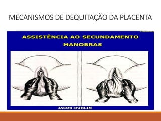 MECANISMOS DE DEQUITAÇÃO DA PLACENTA
 