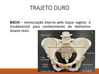 TRAJETO DURO
BACIA – mensuração interna pelo toque vaginal é
fundamental para conhecimento do diâmetros
ósseos reais.
 