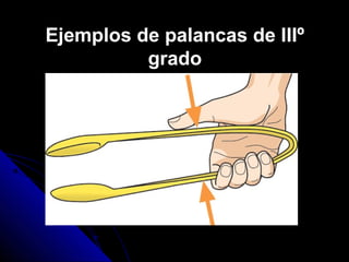 Ejemplos de palancas de IIIº
grado
 