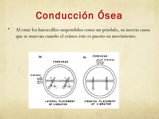 Conducción Ósea
• Al estar los huesecillos suspendidos como un péndulo, su inercia causa
que se muevan cuando el cráneo éste es puesto en movimiento.
 