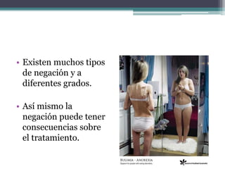 • Existen muchos tipos
de negación y a
diferentes grados.
• Así mismo la
negación puede tener
consecuencias sobre
el tratamiento.
 
