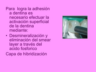 Smearing Adhesion Example Mecanismos de adhesion a esmalte y dentina | PPT