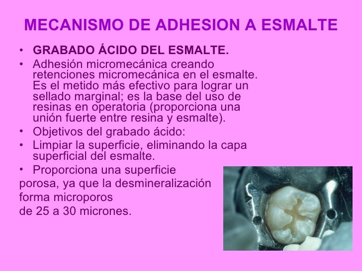 Mecanismos de adhesion a esmalte y dentina