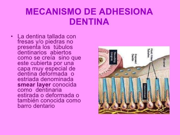 Mecanismos de adhesion a esmalte y dentina