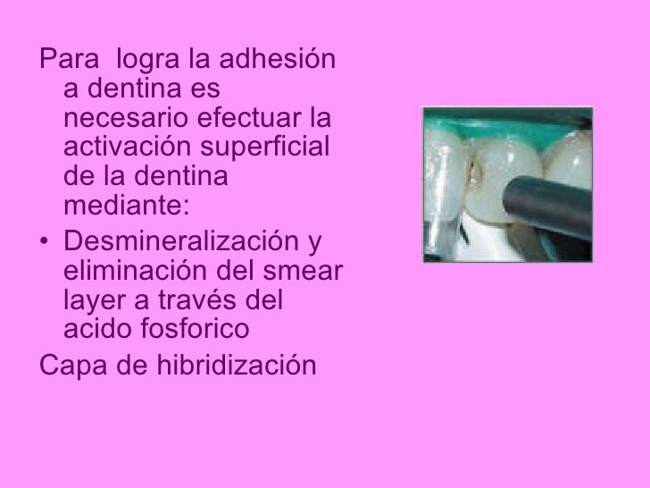 Mecanismos de adhesion a esmalte y dentina
