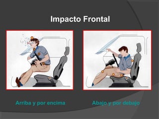 Impacto Frontal
Arriba y por encima Abajo y por debajo
 