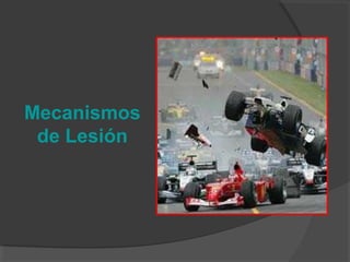 Mecanismos
de Lesión
 