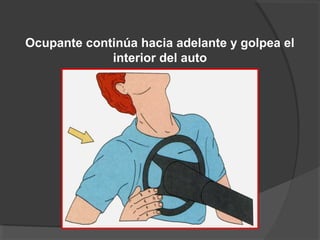 Ocupante continúa hacia adelante y golpea el
interior del auto
 