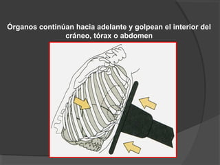 Órganos continúan hacia adelante y golpean el interior del
cráneo, tórax o abdomen
 