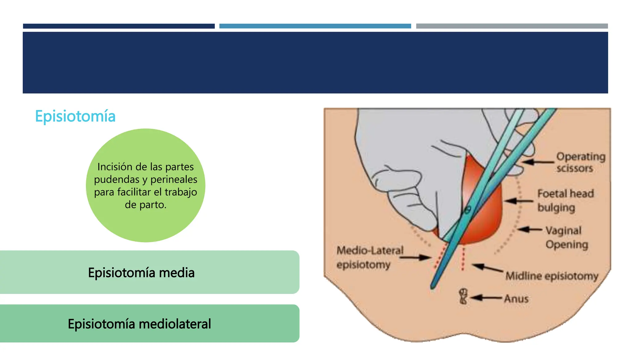 Incision Wikipedia Mecanismos del trabajo de parto y atención del parto normal.pptx