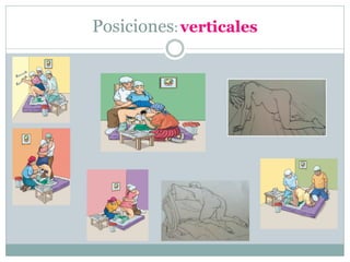 Posiciones:verticales
 