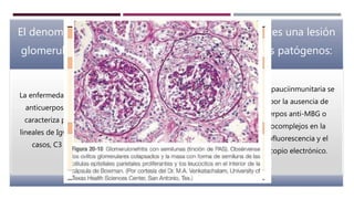 El denominador común de todos los tipos de GNRP es una lesión
glomerular grave. Y se describen varios mecanismos patógenos:
La enfermedad mediada por
anticuerpos anti-MBG se
caracteriza por depósitos
lineales de IgG y en muchos
casos, C3 en la MBG.
Enfermedades causadas por el
depósito de inmunocomplejos.
La GNRP puede ser una
complicación de cualquiera de
las nefritis por
inmunocomplejos, como la
Glomerulonefritis postinfecciosa,
lúpica, de IgA, etc.
La GNRP pauciinmunitaria se
define por la ausencia de
anticuerpos anti-MBG o
inmunocomplejos en la
inmunofluorescencia y el
microscopio electrónico.
 