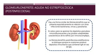 GLOMEURLONEFRITIS AGUDA NO ESTREPTOCÓCICA
(POSTINFECCIOSA):
Hay una forma similar de Glomerulonefritis que se
presenta esporádicamente en relación con otras
infecciones bacterianas, víricas y parasitarias.
En estos casos se aprecian los depósitos granulares
inmunofluorescentes y las jorobas subepiteliales
característicos de la nefritis por inmunocomplejos,
La Glomerulonefritis postinfecciosa estafilocócica
se distingue porque en ocasiones produce
depósitos inmunitarios que contienen IgA en vez
de IgG.
 