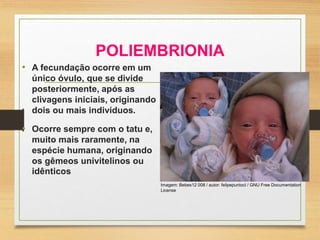 POLIEMBRIONIA
• A fecundação ocorre em um
único óvulo, que se divide
posteriormente, após as
clivagens iniciais, originando
dois ou mais indivíduos.
• Ocorre sempre com o tatu e,
muito mais raramente, na
espécie humana, originando
os gêmeos univitelinos ou
idênticos
Imagem: Bebes12 008 / autor: felipepuntocl / GNU Free Documentation
License
 