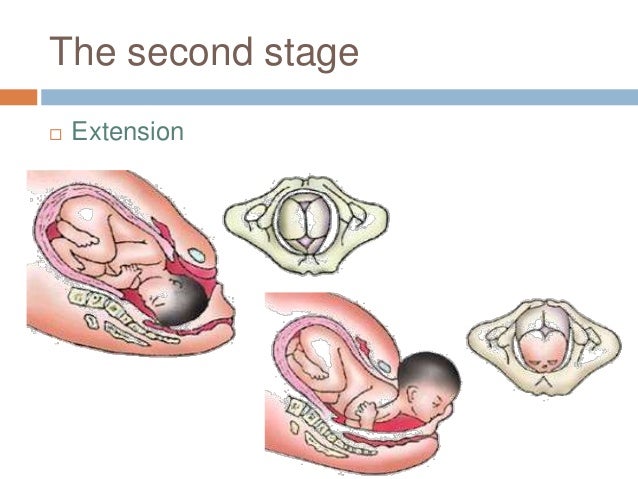 Mechanism of normal labour