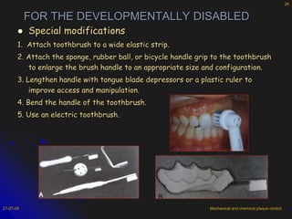 Toothbrush Modifications Mechanical and chemical plaque control | PPTX