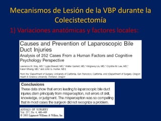 Mecanismos de Lesión de la VBP durante la
Colecistectomía
1) Variaciones anatómicas y factores locales:

 