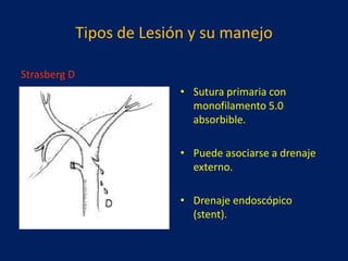 Tipos de Lesión y su manejo
Strasberg D
• Sutura primaria con
monofilamento 5.0
absorbible.
• Puede asociarse a drenaje
externo.
• Drenaje endoscópico
(stent).

 