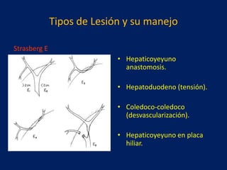 Tipos de Lesión y su manejo
Strasberg E
• Hepaticoyeyuno
anastomosis.
• Hepatoduodeno (tensión).
• Coledoco-coledoco
(desvascularización).
• Hepaticoyeyuno en placa
hiliar.

 